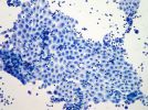 Cytopathology